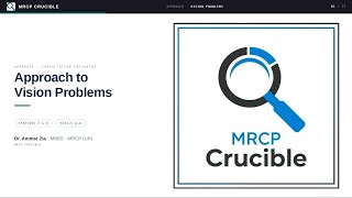 How to Approach Vision Problems (Redness of Eyes) in MRCP PACES | Long Clinical Consultation