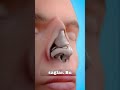 Burun Ameliyatı Nasıl Yapılıyor Ilginçbilgiler Burunestetiği Estetik Bilim Burun Ameliyatı Nasıl Yapılıyor Ilginçbilgiler Burunestetiği Estetik Bilim