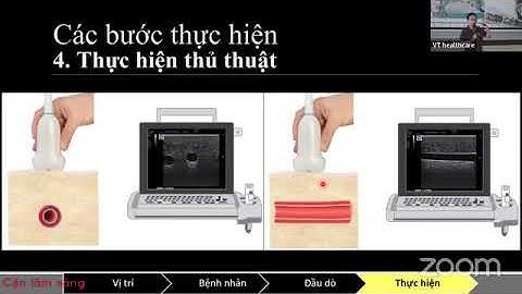 Siêu âm hướng dẫn thủ thuật thiết lập đường truyền tĩnh mạch trung tâm | ThS. BS. NGUYỄN BÍCH TRĂM
