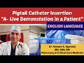 Pigtail Catheter InsertionENGLISH-