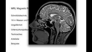 * MRI, Kernspintomographie