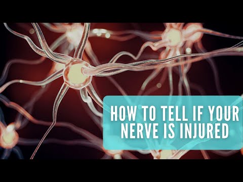 Nerve Injuries: Causes and Symptoms of Nerve Injuries and Pain