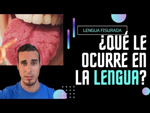 Video: 4 formas de curar una lengua mordida