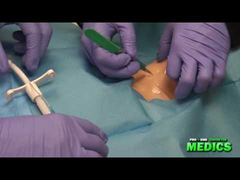 Surgical Cricothyrotomy by the Paramedic Intern 