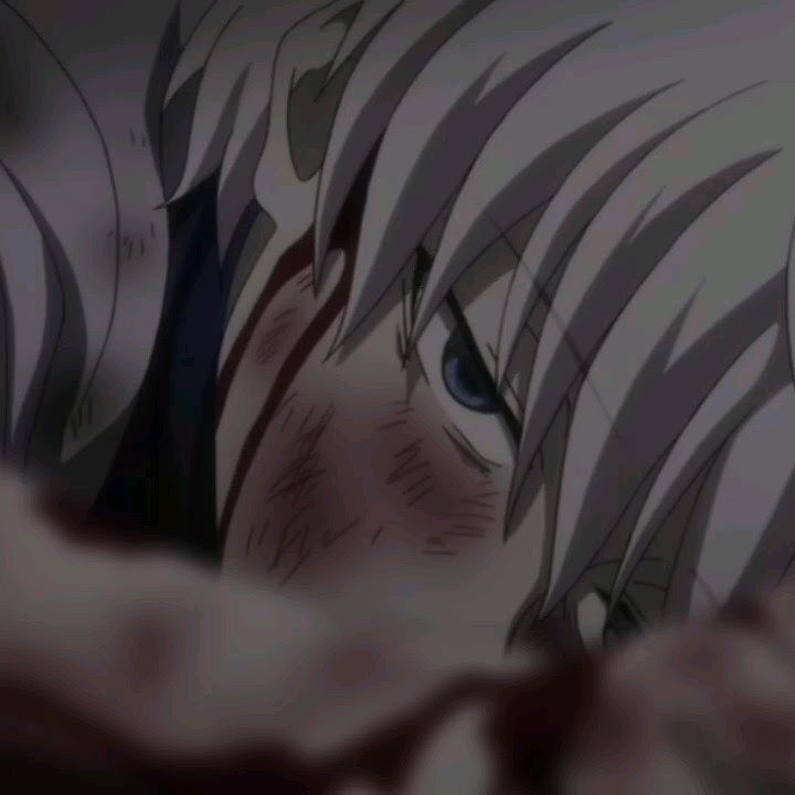 [Hunter x Hunter] Killua Zoldyck | sad edit