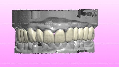Dental Lab Excellence: Full Zirconia Bridge Production with CAD/CAM Technology