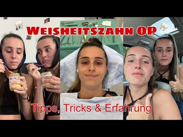 elfbar elfa master akku Wisdom tooth surgery - tips, tricks & experience with local anesthesia |  lesotwins 👯‍♀️