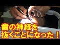 歯の神経を抜くことになった！【岡山キッズタレントsana (さな７歳)】