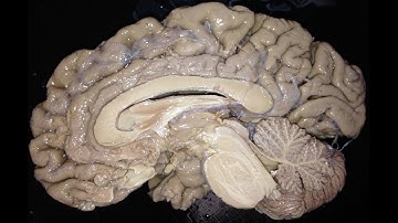 Introduction to Neuroanatomy: Human and Sheep Brain Dissections