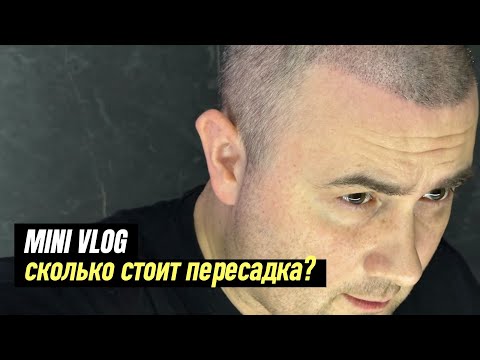 Видео: Сколько стоит пересадка волос в России? Андрей Алистаров