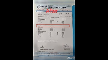 albuminuria, proteinuria success case