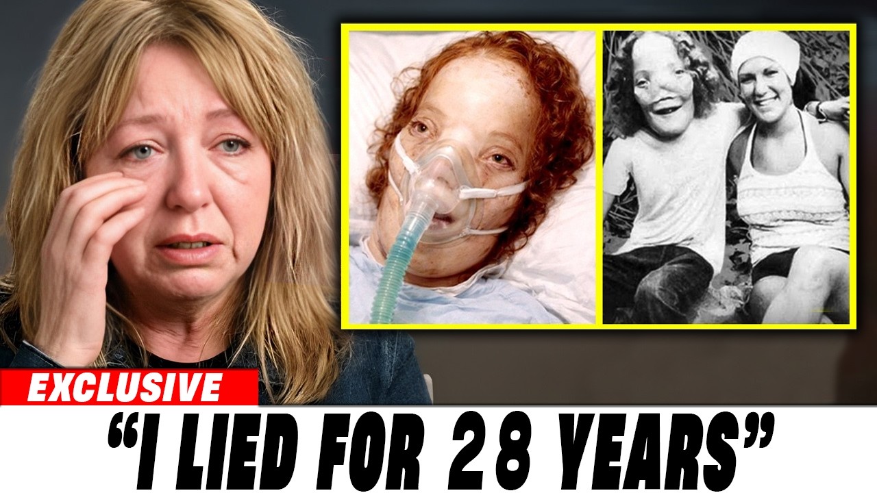 Before Her Death, Rocky Dennis’s Mom FINALLY Exposed A Dark Secret She