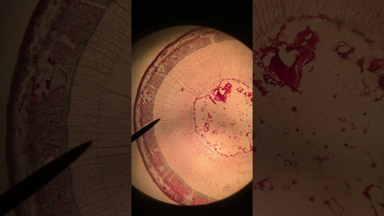 Woody Stem Cross Section