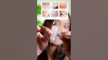 Remove Scar using this 😱‼️ #scarremoval #acnescars #scars