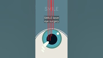 How Laser Eye Surgery Works! #shorts