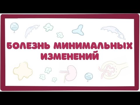 Видео: Почему отеки при нефротическом синдроме?