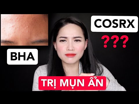 [REVIEW] SỰ THẬT VỀ CÁC SẢN PHẨM TRỊ MỤN ẨN COSRX LINH DÙNG ??? Ha Linh Official | Foci