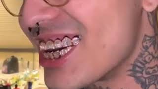 Lil Pump Shows Off New Rose D Grill