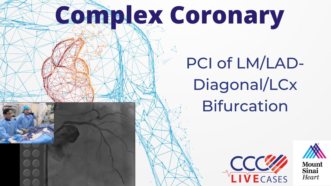 PCI Of LM LAD Diagonal LCx Bifurcation August 21 2018 YouTube pci-of-lm-lad-diagonal-lcx-bifurcation-august-21-2018-youtube