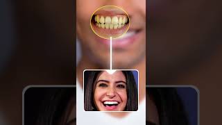 Celebrity Smile Secrets Revealed 😲 | How Stars Get That Perfect Smile! #shorts #ytshorts #smile