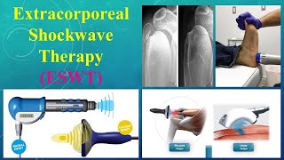 Extracorporeal Shockwave Therapy (ESWT)Section-Electrotherapy-2nd Year Physical Therapy Students SVU