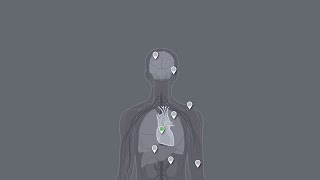 How can TCE exposure affect adults and children? - Heart