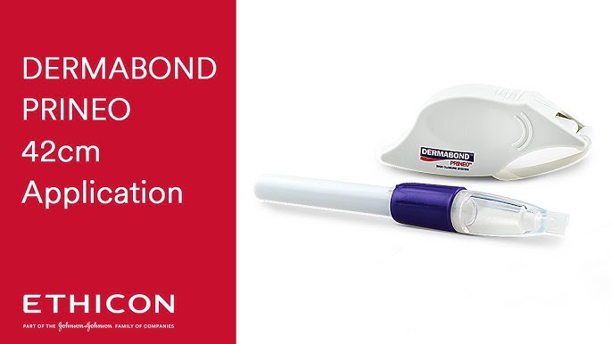 Step-by-Step Guide for Effective Application of DERMABOND PRINEO Skin  Closure System