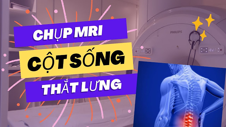 Chụp mri cột sống giá bao nhiêu năm 2024