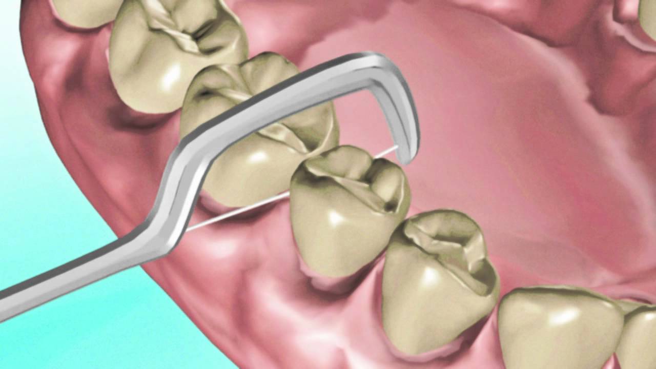 Interdental cleaning YouTube