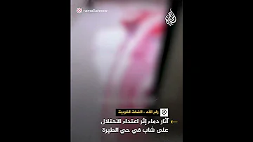 آثار دماء إثر اعتداء الاحتلال الإسرائيلي على شاب أثناء اعتقاله في حي الطيرة برام الله 