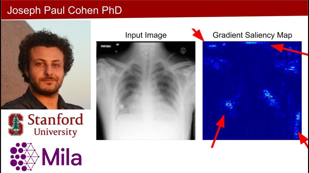 Is medical image analysis with deep learning ready? - YouTube
