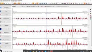 InSite-Bytes: Waveform Picking