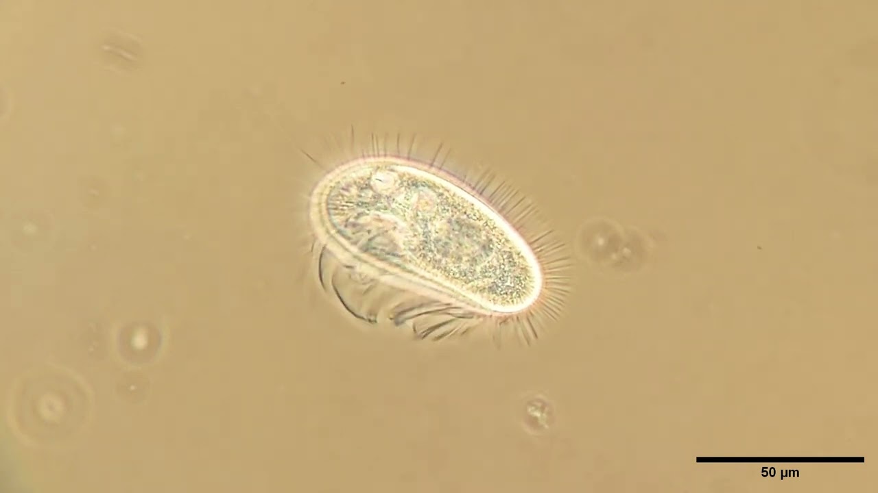 Pleuronema coronatum, phase contrast