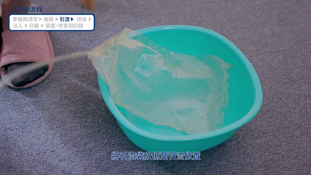 CAPD連續性可攜帶腹膜透析教學影片