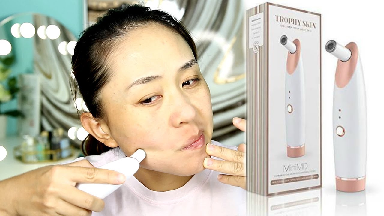 TROPHY SKIN MINIMD - MICRODERMABRASION SYSTEM REVIEW/FIRST IMPRESSION 