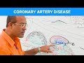 Coronary Artery Disease - Ischemic Heart Disease - Angina