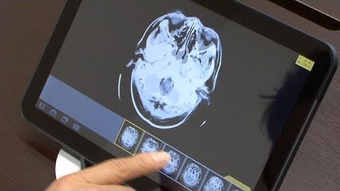 Fast, Secure Transmission Of Medical Images To Smartphones And Tablets #diginfo