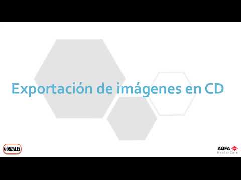 Exportación de imágenes en CD | Agfa NX