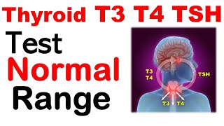 Thyroid t3 t4 tsh normal values | Thyroid test normal range screenshot 3