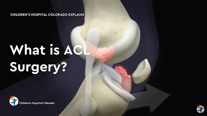What is ACL Surgery? - DayDayNews