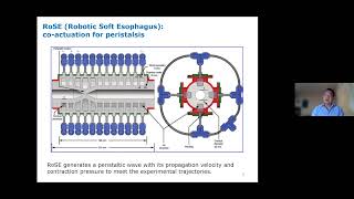 Peter Xu  Digestion Robotics, 24 March 2022 screenshot 5