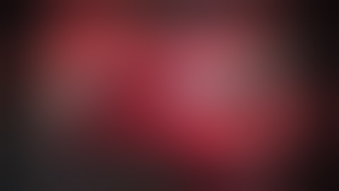 Retroperitoneal Robotic-Assisted Partial Nephrectomy in Solitary Kidney for Endophytic, Central Mass