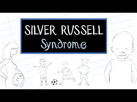 What is Silver-Russell Syndrome (SRS)?