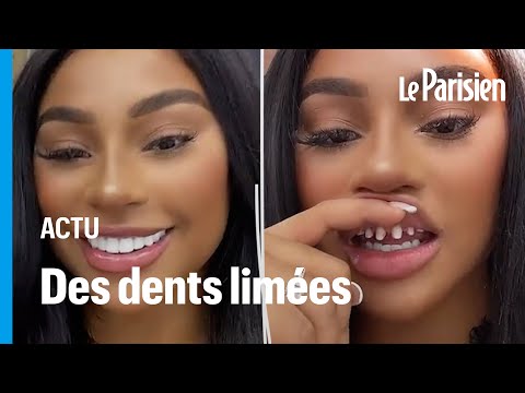 Vidéo: Pourquoi j'ai les dents en biseau ?