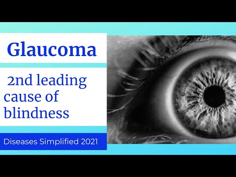 Glaucoma, 2nd leading cause of blindness