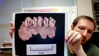Isotopes in Archeology