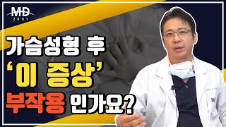 가슴성형 부작용 종류와 해결방법! 가슴수술 구형구축, 리플링 현상, 애니메이션 변형, 짝가슴, 윗볼록, 밑빠짐, 옆빠짐, 유방합체증 등 완벽정리!