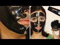 DIY - MASCARILLA DE CARBON ACTIVADO PARA ELIMINAR EL ACNE VS PILATEN ORIGINAL ¿Funciona?| DelynnLove