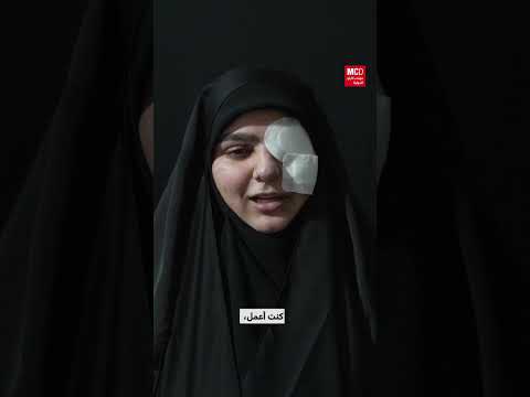 إصابة فتاة بانفجار جهاز إلكتروني في المنزل
