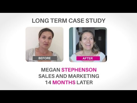 Long Term Case Study: Megan Stephenson, 14 Months